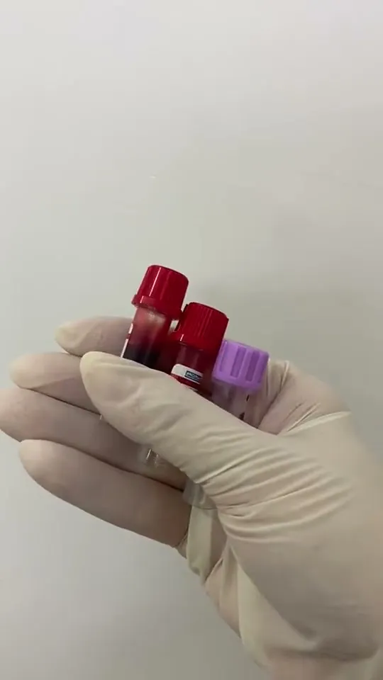 Mão enluvada segurando tubos com o sangue colhido para os exames