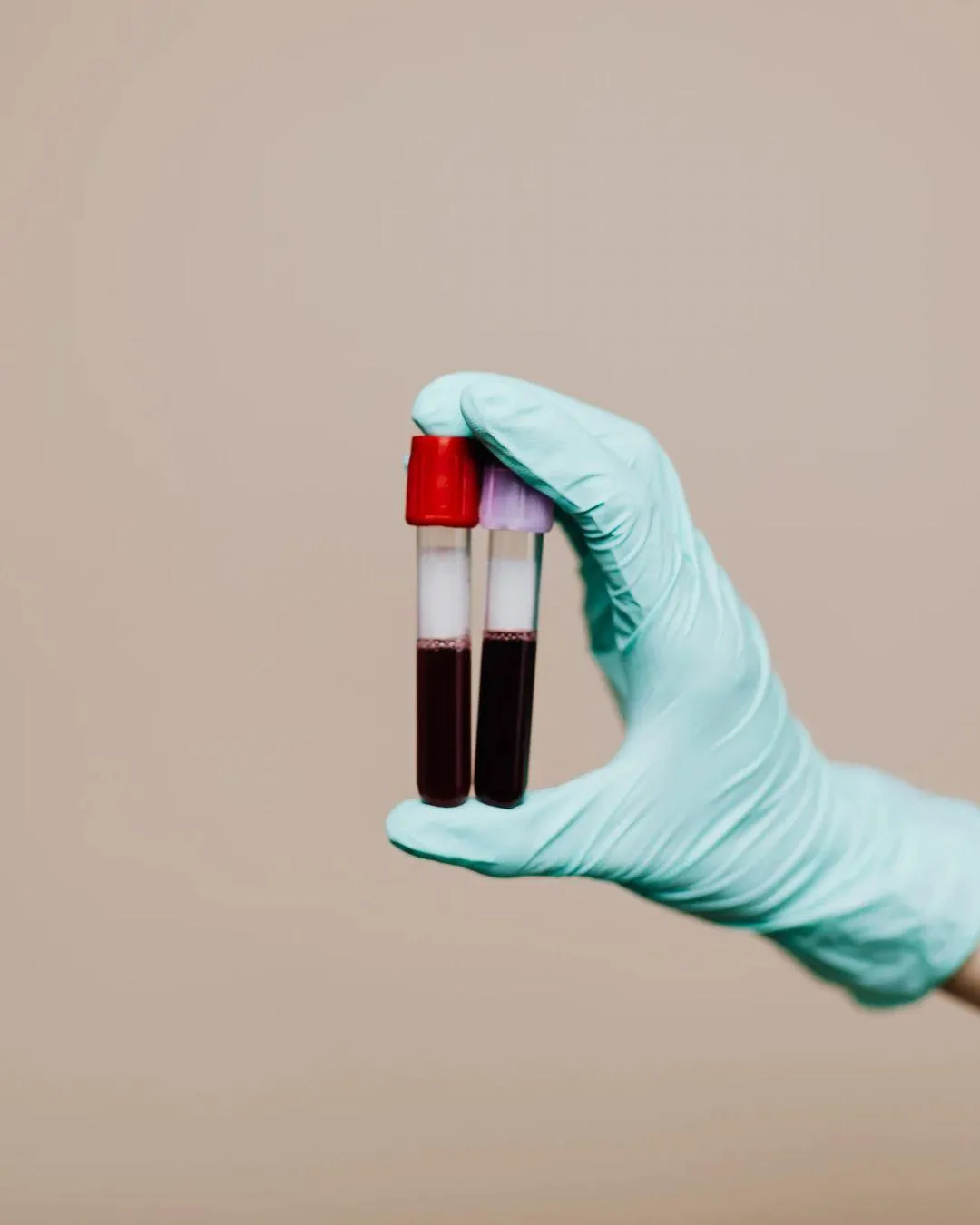 Tubos de coleta de sangue na mão enluvada de um profissional do laboratório
