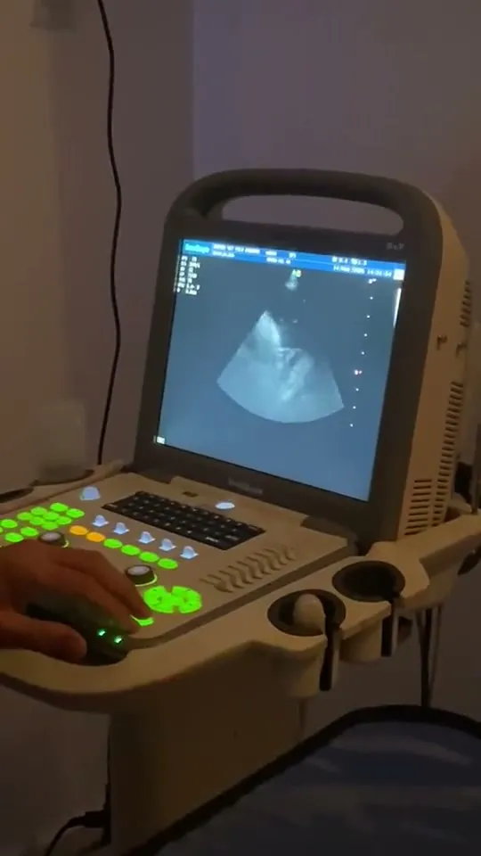Aparelho de ultrassonografia da clínica em uso, com a imagem do exame na tela